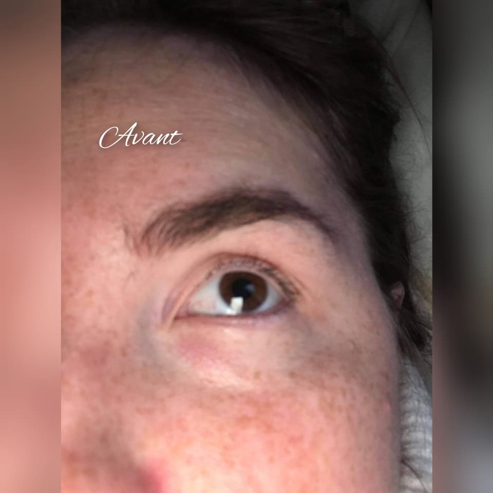 cils