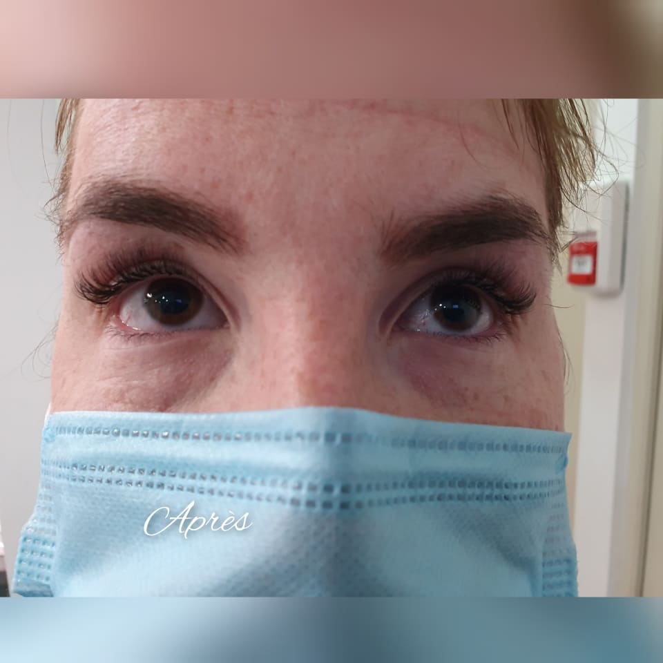 cils