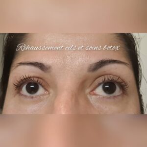 Rehaussement